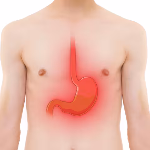 Heartburn