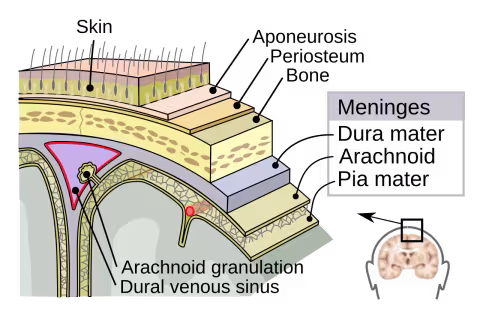 Meningitis